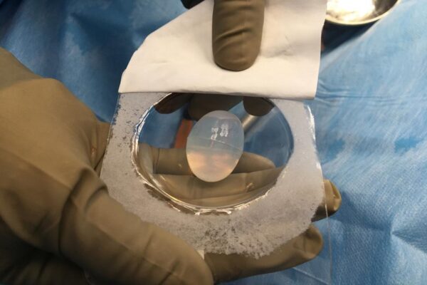 Artificial Testis give huge relief to youth – KIMS doctors fix the issue successfully